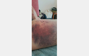 ENCORE UN BLESSE Olivier TEXIER