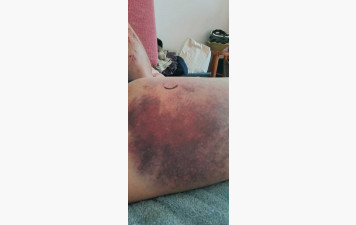 ENCORE UN BLESSE Olivier TEXIER